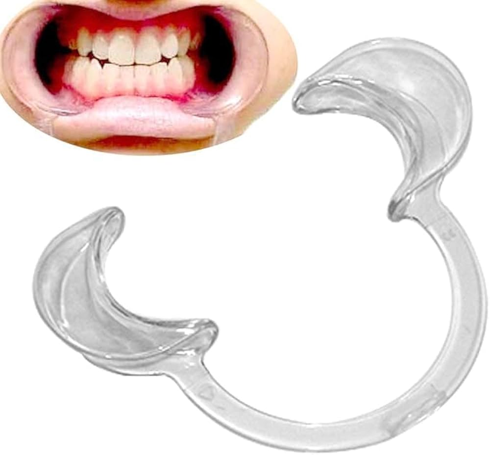 Cheek retractor