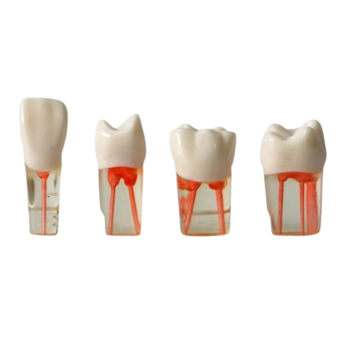 Endo teeth
