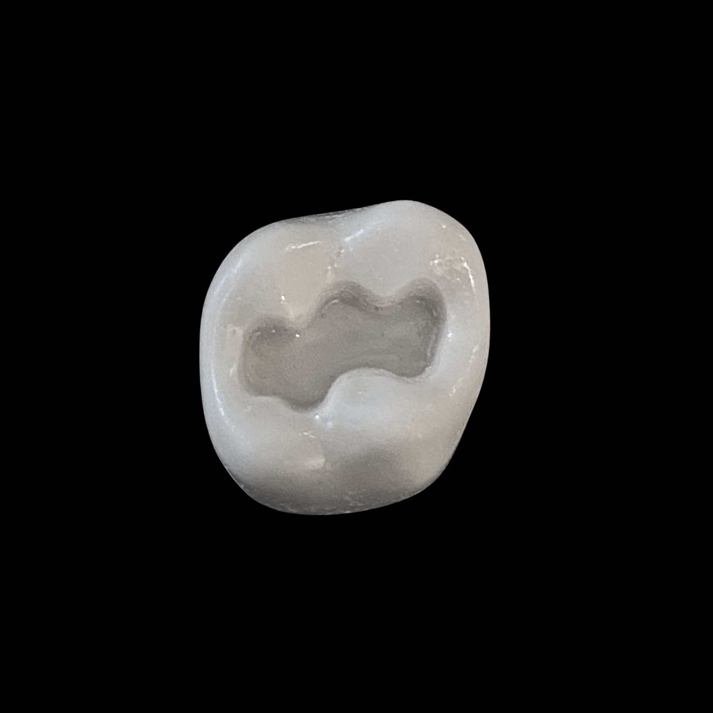 Japan prepared teeth